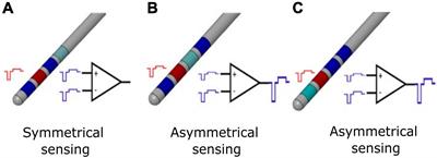 A New Implantable Closed-Loop Clinical Neural Interface: First Application in Parkinson’s Disease